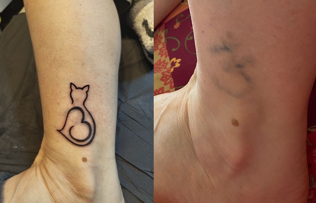 Coverup über eine gelasertes Tattoo in Form einer Katze
